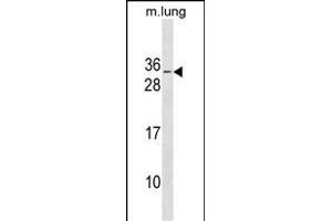 RBM7 Antibody (C-term) (ABIN1881733 and ABIN2838623) western blot analysis in mouse lung tissue lysates (35 μg/lane).