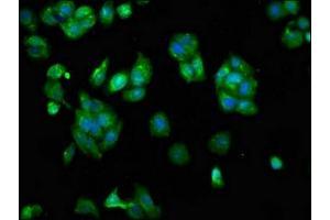 Immunofluorescence staining of HepG2 cells with ABIN7168610 at 1:133, counter-stained with DAPI. (SCARA5 antibody  (AA 303-428))