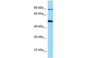 WB Suggested Anti-BMP4 Antibody Titration: 1. (BMP4 antibody  (N-Term))