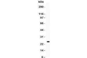 Western blot testing of Kallikrein 4 antibody and recombinant human protein (0. (Kallikrein 4 antibody  (AA 31-254))