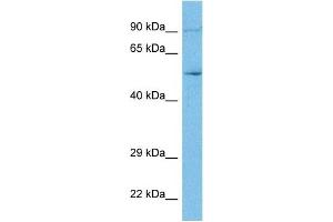 WB Suggested Anti-ACH10 antibody Titration: 1 ug/mL Sample Type: Human MCF7 Whole Cell