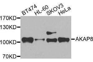 Western blot analysis of extracts of various cells, using AKAP8 antibody.