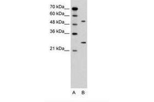 Image no. 2 for anti-Calcium Channel, Voltage-Dependent, beta 1 Subunit (CACNB1) (AA 201-250) antibody (ABIN6736600) (CACNB1 antibody  (AA 201-250))