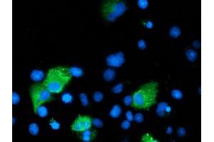 Anti-ARFGAP1 mouse monoclonal antibody (ABIN2454434) immunofluorescent staining of COS7 cells transiently transfected by pCMV6-ENTRY ARFGAP1 (RC206987). (ARFGAP1 antibody)