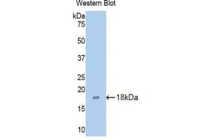 Western blot analysis of the recombinant protein. (Claudin 3 antibody  (AA 30-159))