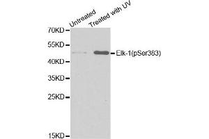 Western Blotting (WB) image for anti-ELK1, Member of ETS Oncogene Family (ELK1) (pSer383) antibody (ABIN1870156) (ELK1 antibody  (pSer383))