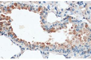 Immunohistochemistry of paraffin-embedded Mouse lung using Aquaporin 4 Polyclonal Antibody at dilution of 1:100 (40x lens). (Aquaporin 4 antibody)