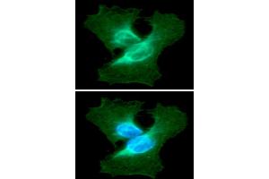 ICC/IF analysis of VIM in HeLa cells line, stained with DAPI (Blue) for nucleus staining and monoclonal anti-human VIM antibody (1:100) with goat anti-mouse IgG-Alexa fluor 488 conjugate (Green). (Vimentin antibody  (AA 1-466))