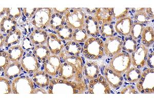 Detection of PKBa in Human Kidney Tissue using Polyclonal Antibody to Protein Kinase B Alpha (PKBa) (AKT1 antibody  (AA 122-443))
