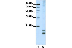 WB Suggested Anti-MAFF Antibody Titration:  5.