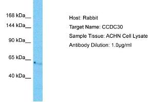 Host: Rabbit Target Name: CCDC30 Sample Tissue: Human ACHN Whole Cell  Antibody Dilution: 1ug/ml (CCDC30 antibody  (C-Term))