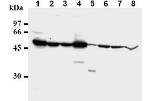 Western Blotting (WB) image for anti-Checkpoint Kinase 1 (CHEK1) antibody (ABIN487487) (CHEK1 antibody)