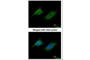 ICC/IF Image Immunofluorescence analysis of paraformaldehyde-fixed HeLa, using NAGLU, antibody at 1:200 dilution. (NAGLU antibody  (Center))