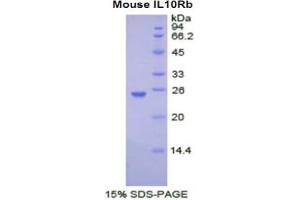 SDS-PAGE analysis of Mouse IL10Rb Protein.