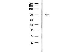 anti-Stimulated By Retinoic Acid 6 (STRA6) antibody