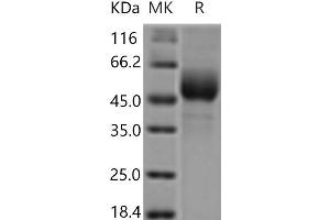 Western Blotting (WB) image for Ninjurin 1 (NINJ1) protein (Fc Tag) (ABIN7321087) (NINJ1 Protein (Fc Tag))