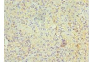 Immunohistochemistry of paraffin-embedded human pancreatic tissue using ABIN7167347 at dilution of 1:100 (Rab4 antibody  (AA 1-218))
