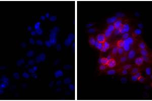 Human epithelial carcinoma cell line HEp-2 was stained with Mouse Anti-Human CD44-UNLB and DAPI. (Goat anti-Mouse IgG (Heavy & Light Chain) Antibody (Texas Red (TR)))