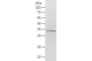 MLF1 Protein (AA 1-268) (His tag)