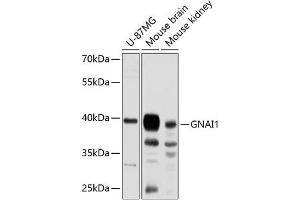 Western blot analysis of extracts of various cell lines, using GN antibody (ABIN6129386, ABIN6141198, ABIN6141199 and ABIN6224811) at 1:3000 dilution. (GNAI1 antibody  (AA 1-354))