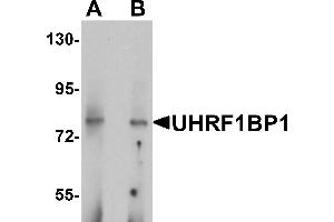 Western blot analysis of UHRF1BP1 in mouse kidney tissue lysate with UHRF1BP1 antibody at (A) 1 and (B) 2 µg/mL. (UHRF1BP1 antibody  (Middle Region))