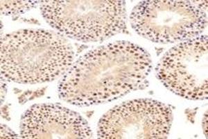 Immunohistochemistry (Paraffin-embedded Sections) (IHC (p)) image for anti-DAZ Associated Protein 1 (DAZAP1) antibody (ABIN7073691)