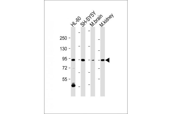 MAP3K12 antibody  (C-Term)