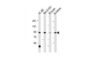 All lanes : Anti-ZPK Antibody (C-term) at 1:2000 dilution Lane 1: HL-60 whole cell lysate Lane 2: SH-SY5Y whole cell lysate Lane 3: Mouse brain lysate Lane 4: Mouse kidney lysate Lysates/proteins at 20 μg per lane. (MAP3K12 antibody  (C-Term))