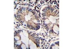 Immunohistochemistry analysis in formalin fixed and paraffin embedded human rectum tissue reacted with NAD-ME Antibody (C-term) followed which was peroxidase conjugated to the secondary antibody and followed by DAB staining. (NAD-ME antibody  (C-Term))