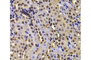 Immunohistochemistry of paraffin-embedded Mouse kidney using WHSC1 Polyclonal Antibody at dilution of 1:100 (40x lens). (WHSC1 antibody)