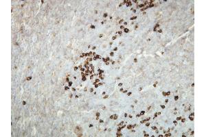 Immunohistochemistry (IHC) image for anti-kappa Light Chain (AA 47-63), (N-Term) antibody (ABIN870362)