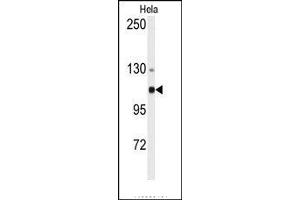 Image no. 1 for anti-Actinin, alpha 4 (ACTN4) (N-Term) antibody (ABIN360099) (alpha Actinin 4 antibody  (N-Term))