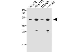 All lanes : Anti-HARS Antibody (N-term) at 1:1000 dilution Lane 1: HepG2 whole cell lysate Lane 2: NIH/3T3 whole cell lysate Lane 3:Mouse brainwhole tissue lysate Lane 4: Rat brain whole tissue lysate Lysates/proteins at 20 μg per lane. (HARS1/Jo-1 antibody  (N-Term))