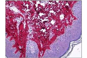 Immunohistochemistry (IHC) image for anti-Collagen, Type I (COL1) antibody (ABIN782308) (Collagen Type I antibody)