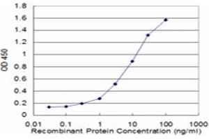 Image no. 1 for anti-S100 Calcium Binding Protein A8 (S100A8) (AA 1-94) antibody (ABIN961221) (S100A8 antibody  (AA 1-94))