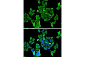 Immunofluorescence (IF) image for anti-Cell Division Cycle and Apoptosis Regulator 1 (CCAR1) antibody (ABIN1980350)