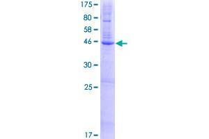 Image no. 1 for Fatty Acid Hydroxylase Domain Containing 2 (FAXDC2) (AA 1-191) protein (GST tag) (ABIN1347586) (C5ORF4 Protein (AA 1-191) (GST tag))