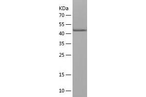 TUBA1A Protein (AA 214-413) (His-IF2DI Tag)