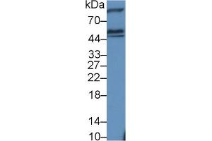 Detection of HEXa in Rat Cerebrum lysate using Polyclonal Antibody to Hexosaminidase A Alpha (HEXa) (Hexosaminidase A antibody  (AA 318-529))