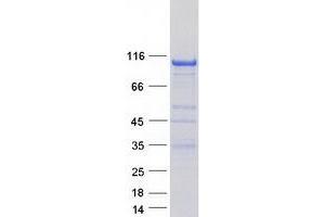 Validation with Western Blot (PTK2B Protein (Transcript Variant 2) (Myc-DYKDDDDK Tag))