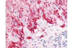 Anti-SLC1A3 / GLAST antibody IHC of human brain, cerebellum, molecular layer and Purkinje layer. (SLC1A3 antibody  (Cytoplasmic Domain))