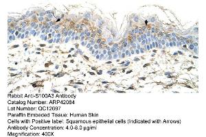 Rabbit Anti-S100A3 Antibody  Paraffin Embedded Tissue: Human Skin Cellular Data: Squamous epithelial cells Antibody Concentration: 4. (S100A3 antibody  (N-Term))