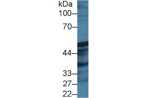Western Blot; Sample: Rat Prostate lysate; Primary Ab: 2µg/ml Rabbit Anti-Human PTGIS Antibody Second Ab: 0. (PTGIS antibody  (AA 1-500))
