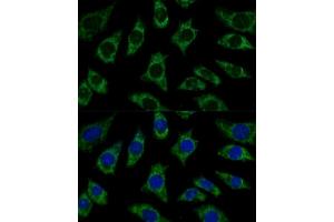 Immunofluorescence analysis of L929 cells using ETFB Polyclonal Antibody (ABIN7266916) at dilution of 1:100 (40x lens). (ETFB antibody  (AA 80-230))