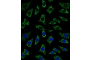 Immunofluorescence analysis of L929 cells using ETFB Polyclonal Antibody (ABIN7266916) at dilution of 1:100 (40x lens).