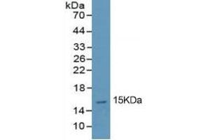 Rabbit Capture antibody from the kit in WB with Positive Control: Human lung tissue lysate. (PINP ELISA Kit)