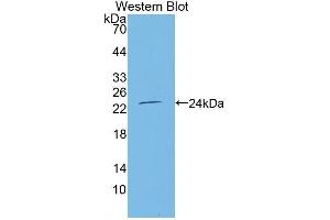 Western Blotting (WB) image for anti-Tumor Necrosis Factor Receptor Superfamily, Member 11a, NFKB Activator (TNFRSF11A) (AA 31-214) antibody (ABIN1863084)