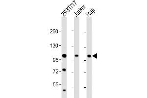 All lanes : Anti-REST Antibody (Center) at 1:2000 dilution Lane 1: 293T/17 whole cell lysate Lane 2: Jurkat whole cell lysate Lane 3: Raji whole cell lysate Lysates/proteins at 20 μg per lane. (REST antibody  (AA 542-570))