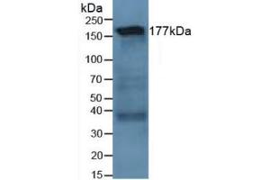 Western blot analysis of Human Lung Tissue. (Laminin gamma 1 antibody  (AA 521-772))