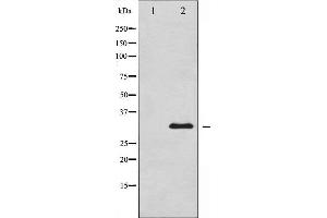 Western blot analysis of BCL-XL expression in UV treated 293 whole cell lysates,The lane on the left is treated with the antigen-specific peptide. (BCL2L1 antibody  (Internal Region))
